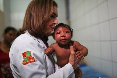 ジカウイルスと小頭症の関連に証拠、神経前駆細胞を損傷 米研究 - ảnh 1