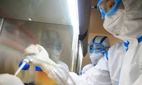 Russian official warns of novel coronavirus complications