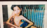ハノイで、枯葉剤被害者に関する写真展