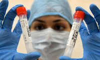 Russia to begin COVID-19 vaccine production in November 