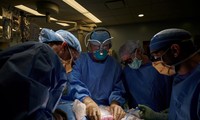 US surgeons successfully test pig kidney transplant in human patient