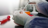 Cooperan Estados Unidos y China en tratamiento del coronavirus MERS