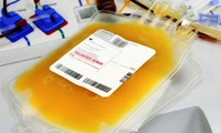 Donación de plasma para pacientes con covid-19: una respuesta amplia en Vietnam