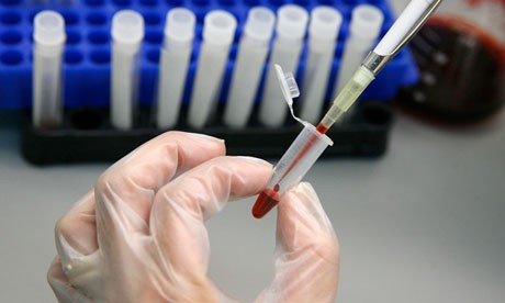 Expanding global access to HIV testing and treatment