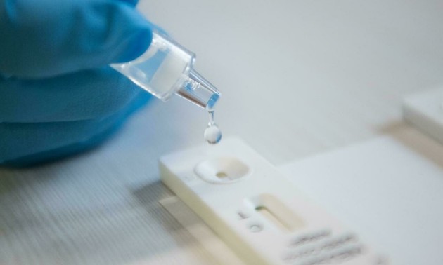 Les tests antigéniques moins sensibles à Omicron, selon les autorités sanitaires américaines