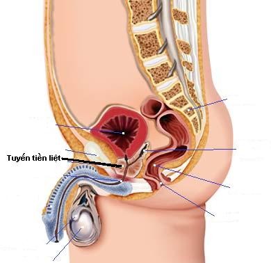 Chế độ sinh hoạt  hợp lý  để điều trị phì đại lành tính tuyến tiền liệt