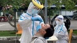 Covid-19: 149 nouveaux cas confirmés ce lundi midi