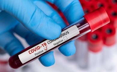 บทที่ 23 ตอนที่ 1 : “โก -วิด -19” 