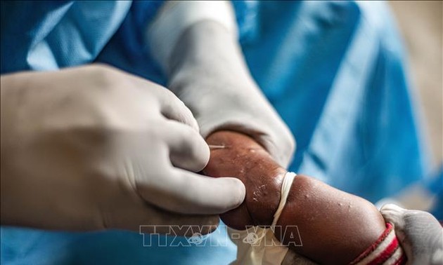 WHO says mpox still a global health emergency