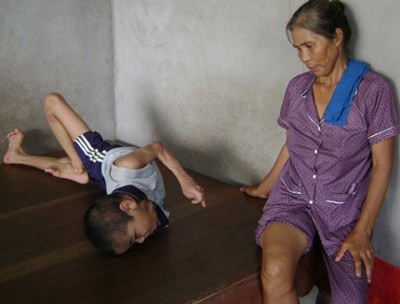 Борьба за справедливость для жертв дефолианта "эйджент-оранж"