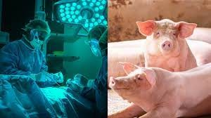 Le rein d'un porc transplanté avec succès sur un humain, une première mondiale 