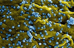 Virus de Marburg: premier essai clinique lancé au Rwanda