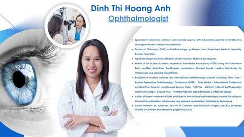 Myopia–Hyperopia–Astigmatism and common misconceptions - ảnh 1