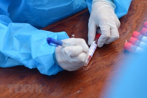 Vietnam confirms 28 more COVID-19 cases Tuesday morning in locked down areas - ảnh 1