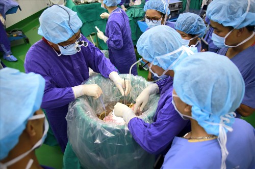 Erfolg des Freundschaftskrankenhauses Viet-Duc in der Lungentransplantation - ảnh 1