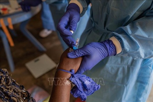 WHO: Mpox-Infektion in Afrika ist noch „besonders besorgniserregend“ - ảnh 1