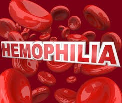 ຫວຽດນາມ ມີ 30.000ຄົນ ມີ gen ພະຍາດ hemophialia - ảnh 1