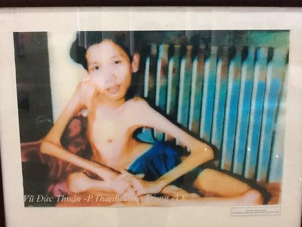 ハノイで、枯葉剤被害者に関する写真展 - ảnh 1
