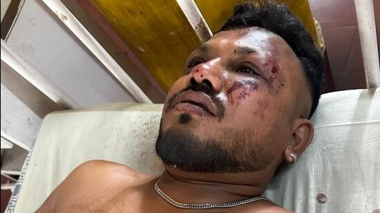 インド 旅客機墜落 1人生存も残る - ảnh 1