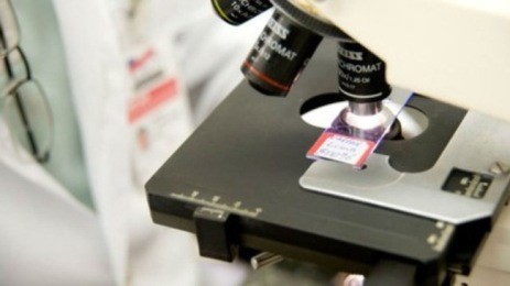 復旦大学、米機関と協力してＭＥＲＳウイルス抗体の開発に成功 - ảnh 1